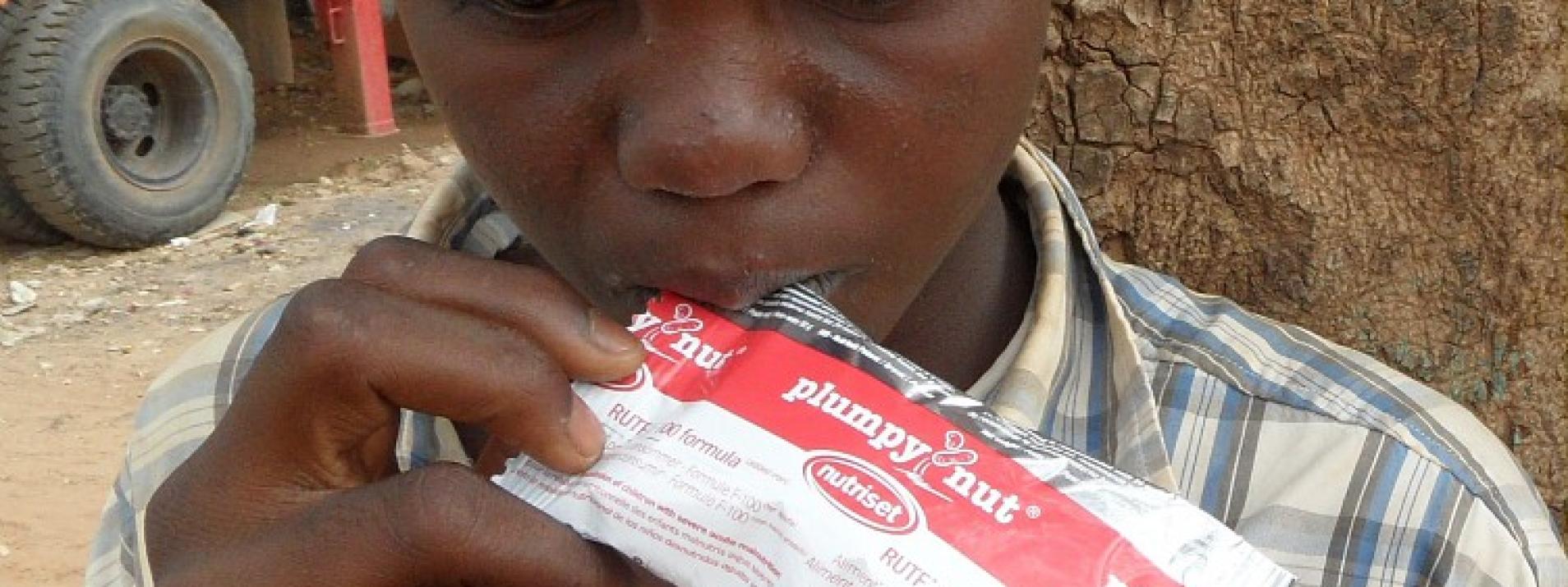 Miniature Groupement de recherche sur la dysbiose associée à la malnutrition aigüe sévère